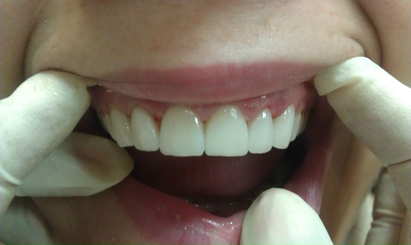 Эрнест Абрамян | Москва