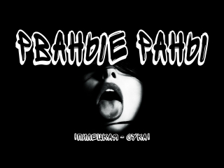 РВАНЫЕ РАНЫ - Пилецкая с*ка! (Официальный клип)